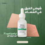 ديرما تن سيروم نياسيناميد 5% لتصغير المسام و تنظيم افرازات الدهون 30 مل - derma 10 - Image 4